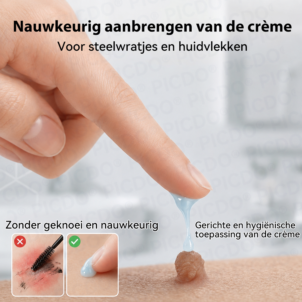 👩‍⚕️𝑺𝒖𝒊𝒊𝒂𝒐® 𝟕-𝐃𝐚𝐠𝐞𝐧 𝐇𝐮𝐢𝐝𝐥𝐢𝐩𝐣𝐞𝐬- & 𝐕𝐥𝐞𝐤𝐤𝐞𝐧𝐯𝐞𝐫𝐰𝐢𝐣𝐝𝐞𝐫𝐢𝐧𝐠𝐬𝐜𝐫è𝐦𝐞 (Pijnloze Formule – Zonder Littekens)☀️