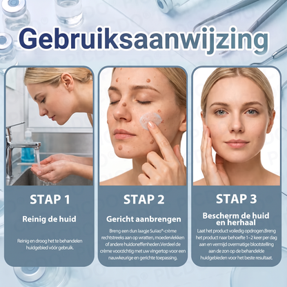 👩‍⚕️𝑺𝒖𝒊𝒊𝒂𝒐® 𝟕-𝐃𝐚𝐠𝐞𝐧 𝐇𝐮𝐢𝐝𝐥𝐢𝐩𝐣𝐞𝐬- & 𝐕𝐥𝐞𝐤𝐤𝐞𝐧𝐯𝐞𝐫𝐰𝐢𝐣𝐝𝐞𝐫𝐢𝐧𝐠𝐬𝐜𝐫è𝐦𝐞 (Pijnloze Formule – Zonder Littekens)☀️